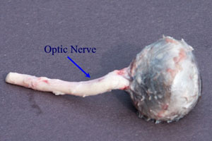 Figure 10 Optic Nerve.JPG